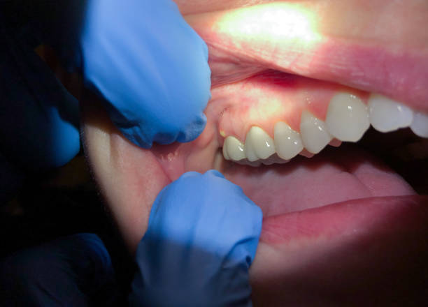 Best After-Hours Dental Trauma Care in Burgettstown, PA