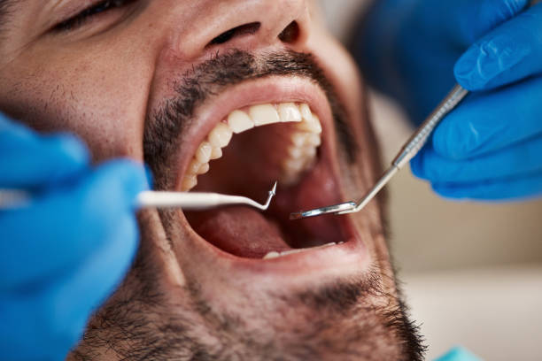 Best Emergency Tooth Extraction in Burgettstown, PA